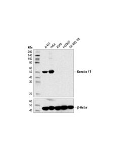 Cell Signaling Keratin 17 (D12e5) Xp ® Rabbit mAb (BSA And Azide Free)
