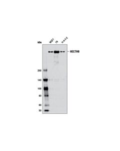 Cell Signaling HECTH9 (AX8D1) Mouse mAb 20 uL