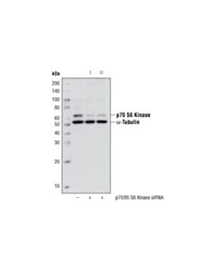 Cell Signaling p70 S6 Kinase (49D7) Rabbit Monoclonal Antibody (Biotinylated)