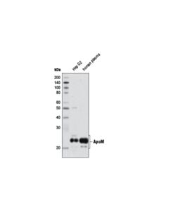 Cell Signaling ApoM (8F12) Mouse mAb 20 uL
