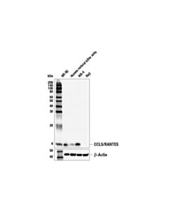 Cell Signaling Ccl5/Rantes (E9s2k) Rabbit mAb (BSA And Azide Free)