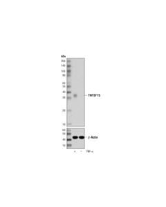 Cell Signaling TNFSF15 (D1C8W) Rabbit mAb 20 uL