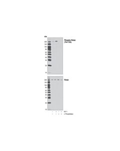 Cell Signaling Phosphoplus Rictor (Thr1135) Antibody Duet