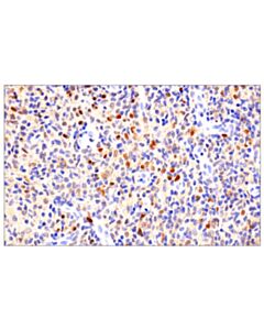 Cell Signaling Notch2 (D76a6) Xp Rabbit mAb