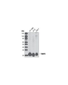 Cell Signaling TIMP2 (D18B7) Rabbit mAb 20 uL