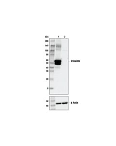 Cell Signaling Vimentin (D21h3) Xp Rabbit mAb