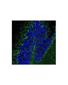 Cell Signaling Neurofilament-L (C28E10) Mouse Chimeric mAb