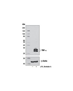 Cell Signaling Tnf-Alpha (D2d4) Xp ® Rabbit mAb (BSA And Azide Free)