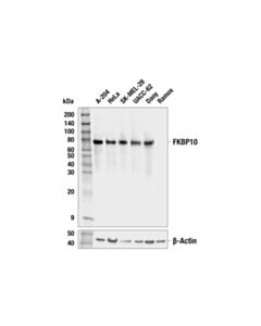 Cell Signaling Fkbp10 (E8m4e) Rabbit mAb