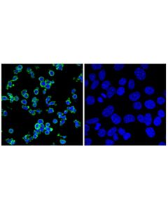 Cell Signaling Lck (F7E4A) Rabbit mAb