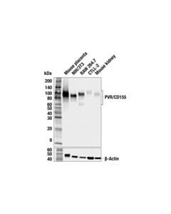 Cell Signaling PVR/CD155 (F3V9H) Rabbit mAb 100 uL