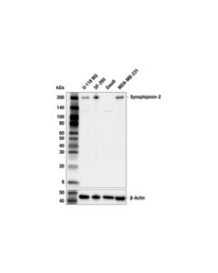 Cell Signaling Synaptojanin-2 (F7C1M) Rabbit mAb