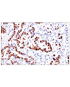 Cell Signaling Gata-6 (D61e4) Xp Rabbit mAb