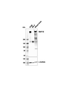 Cell Signaling Map1b Antibody