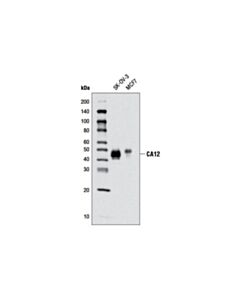Cell Signaling Ca12 (D75c6) Xp Rabbit mAb