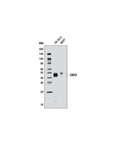 Cell Signaling Ca12 (D78e4) Rabbit mAb