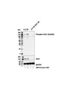 Cell Signaling Phospho-Ulk1 (Ser555) (D1h4) Rabbit mAb