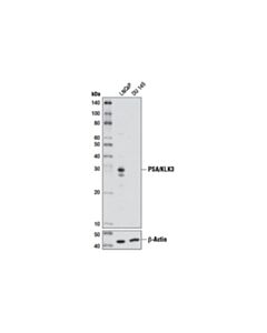 Cell Signaling PSA/KLK3 (D2A8) Rabbit mAb 20 uL