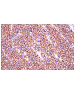 Cell Signaling Na,K-ATPase alpha1 (F7K1P) Rabbit mAb