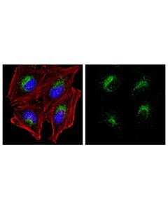 Cell Signaling Lamp1 (D2d11) Xp Rabbit mAb (Alexa Fluor 488 Conjugate)