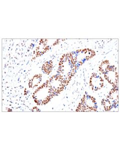 Cell Signaling Foxa1/Hnf3alpha (Ihc578) Mouse mAb