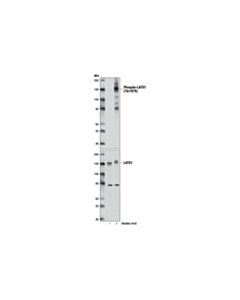 Cell Signaling Okadaic Acid