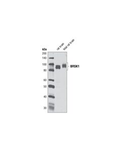 Cell Signaling Brsk1 (D10f2) Rabbit mAb
