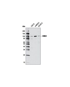 Cell Signaling VMS1 (D10E6) Rabbit mAb 20 uL