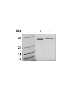 Cell Signaling Human Galectin-3/Lgals3 Recombinant Protein