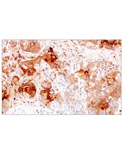 Cell Signaling PIGR (F9A8F) Rabbit mAb