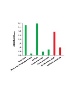 Cell Signaling Pathscan Phospho-Tau (Thr217) Sandwich ELISA Kit