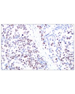 Cell Signaling MASTL (F7I2C) Rabbit mAb
