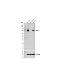 Cell Signaling PKCalpha (D7E6E) Rabbit mAb 20 uL