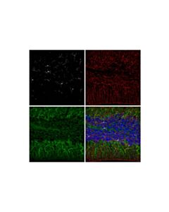 Cell Signaling beta3-Tubulin (D71G9) XP ® Horse Chimeric mAb