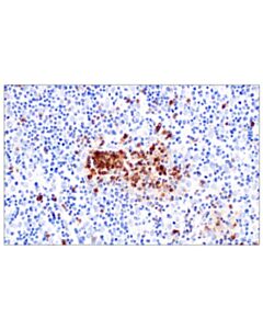 Cell Signaling CCR4 (F9A9K) Rabbit mAb