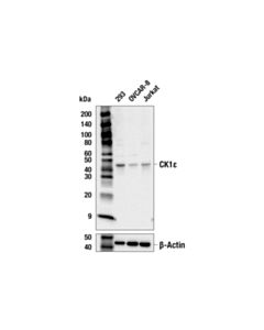 Cell Signaling Ck1epsilon (E6k9v) Rabbit mAb