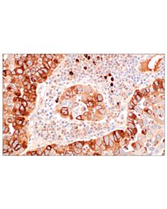 Cell Signaling Osteopontin/SPP1 (F7E5E) Rabbit Monoclonal Antibody