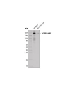 Cell Signaling Her2/Erbb2 (29d8) Rabbit mAb (Hrp Conjugate)