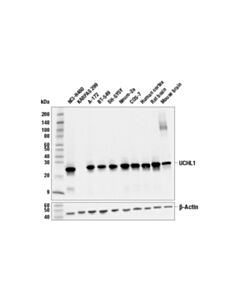 Cell Signaling UCHL1 (E6B8E) Mouse mAb 20 uL
