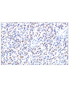 Cell Signaling Mitf (D5) Mouse mAb