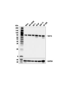 Cell Signaling TAF15 (F4W6X) Rabbit Monoclonal Antibody