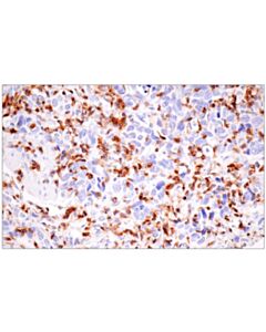 Cell Signaling Slamf6/Cd352 (E3h1e) Xp ® Rabbit mAb