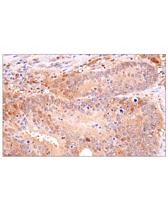 Cell Signaling PBEF/NAMPT (D1K6D) Rabbit mAb 20 uL