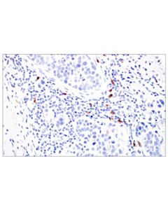 Cell Signaling Trdc/Tcrdelta (E2e9t) Xp Rabbit mAb (BSA And Azide Free)