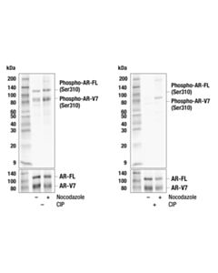 Cell Signaling Phospho-Androgen Receptor (Ser310) (E7L2S) Rabbit mAb 20 uL