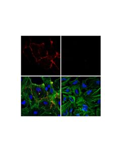 Cell Signaling Cd31 (Pecam-1) (89c2) Mouse mAb (Alexa Fluor 555 Conjugate)