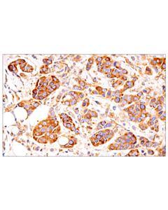 Cell Signaling G3bp1 (E9g1m) Xp Rabbit mAb