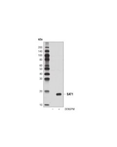 Cell Signaling SAT1 (D1T7M) Rabbit mAb 20 uL