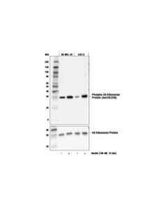 Cell Signaling Phospho-S6 Ribosomal Protein (Ser235/236) (E2r1o) Mouse mAb