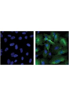 Cell Signaling CD54/ICAM-1 (VF27-516) Mouse mAb 20 uL